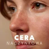 Widoczne zaczerwienienia i drobne naczynka na nosie i policzkach to cechy charakterystyczne cery naczynkowej.