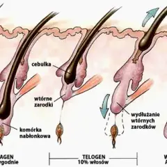 Wypadanie włosów po depilacji laserowej: kiedy i jak to wygląda?