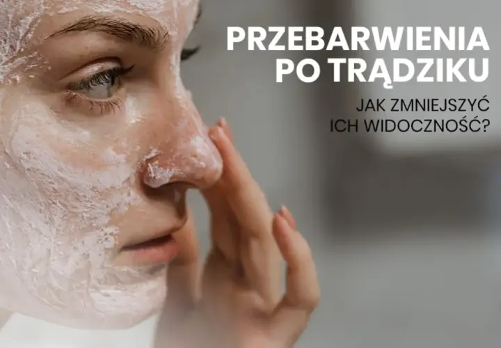 Jak pozbyć się blizn po pryszczach? Domowe i profesjonalne metody