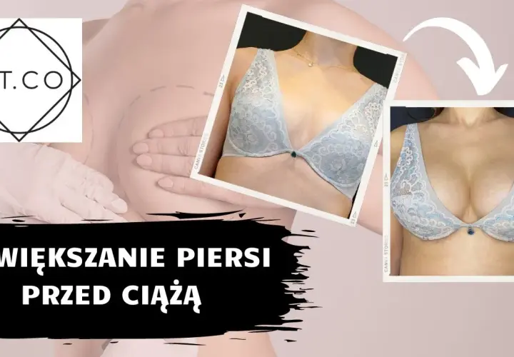Naturalne powiększanie biustu: Fakty, mity i co naprawdę działa?