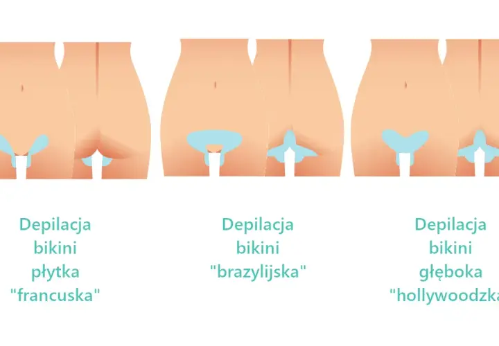 Depilacja bikini: Jak wygląda? Rodzaje, przebieg, porady ekspertki