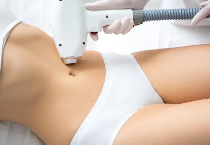 Depilacja laserowa bikini: harmonogram i sekrety trwałej gładkości
