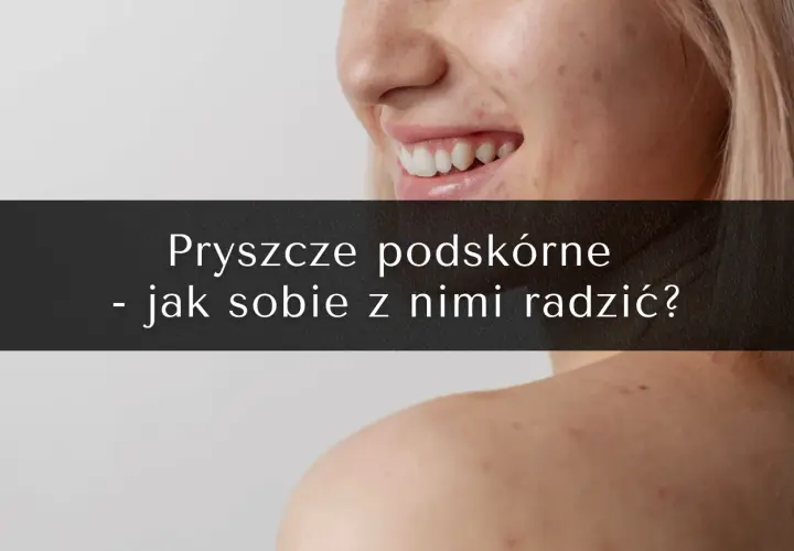 Zbliżenie na twarz i ramię kobiety z widocznymi niedoskonałościami skóry.