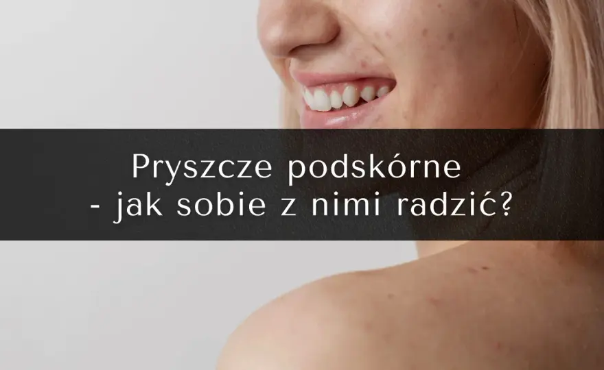 Bolesny pryszcz podskórny? Poznaj plan działania krok po kroku